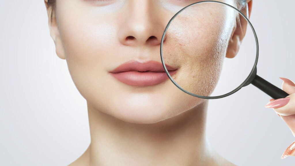 Fraxel laser treatment skin benefits