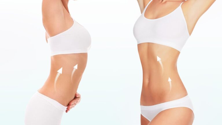 Eliminate Excess Fats, Smoothen And Contour Your Body With Venus Bliss